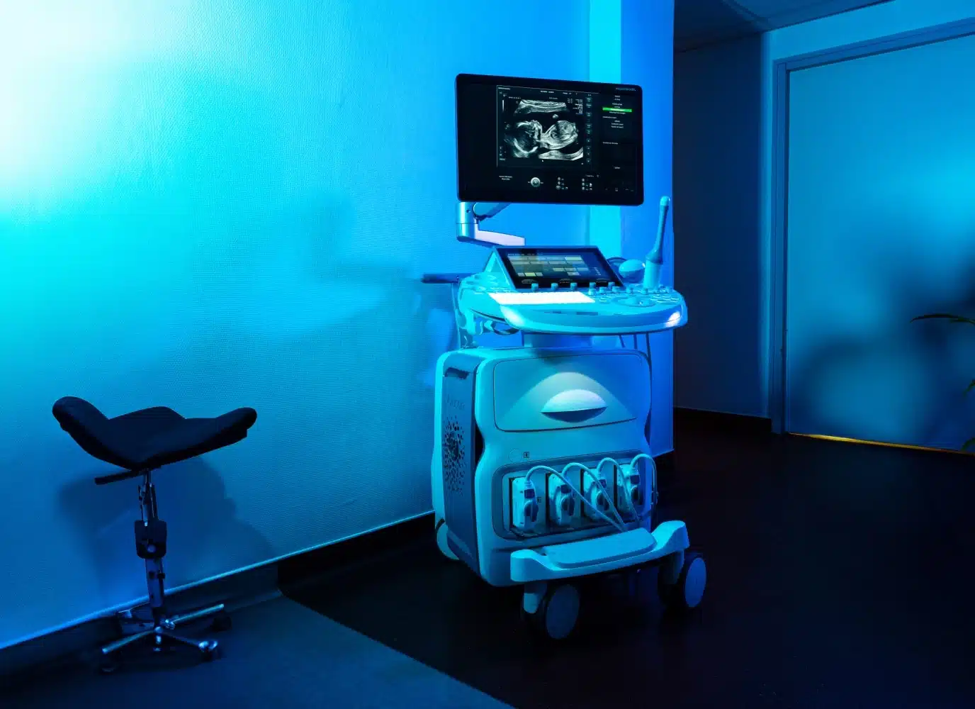 Appareil d echorgraphie au centre IRM et scanner 18eme | Groupe Revelis