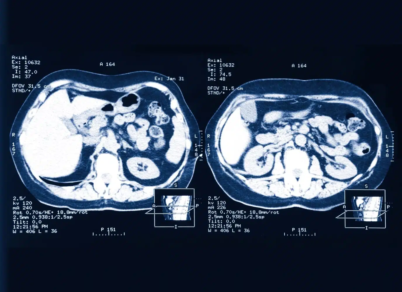 Image rayon x IRM urologique | Groupe Revelis