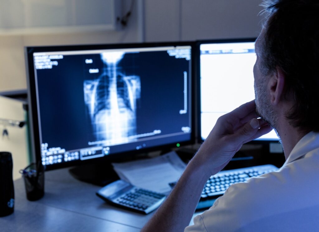 Radiographie pulmonaire | Centre de radiologie | Révélis | Paris
