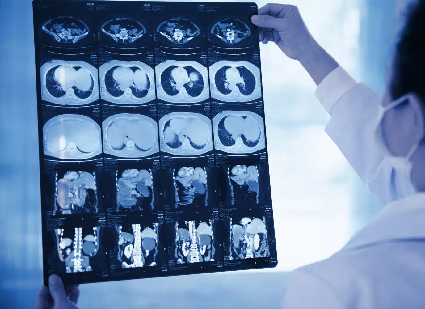 Medecin analyse des radiographie Scanner pelvien | Groupe Revelis