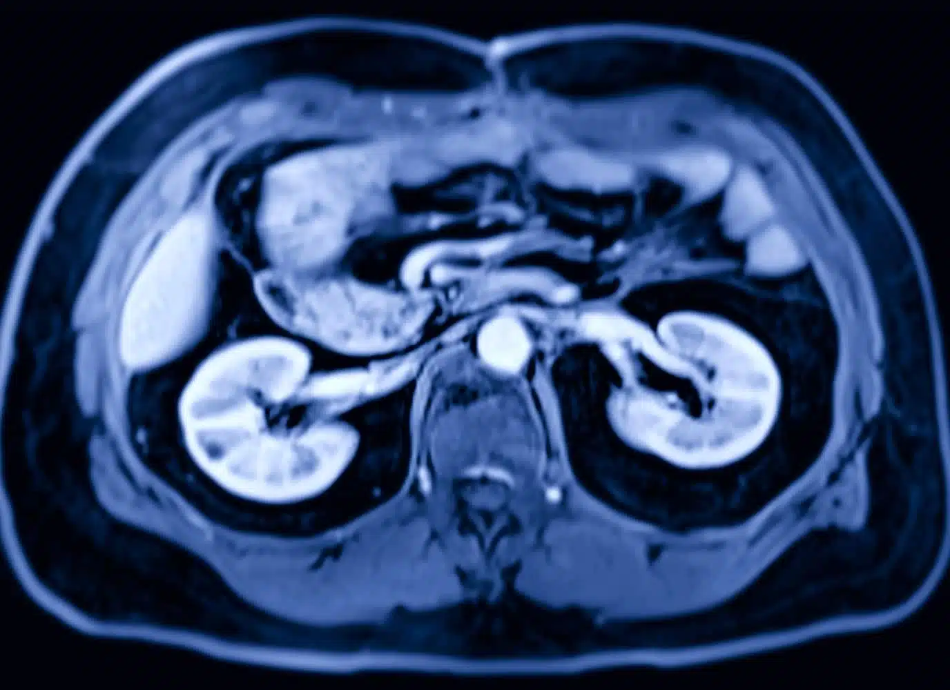 Image rayon X Uroscanner scanner renal vesical et des voies urinaires | Groupe Revelis