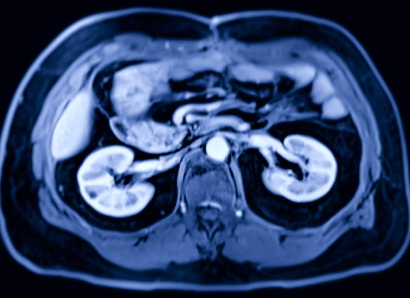 Uroscanner Imagerie M dicale Centre De Radiologie R v lis Paris