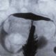 Peut-on faire une hystérosalpingographie avec ses règles ?