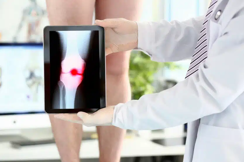 arthrographie