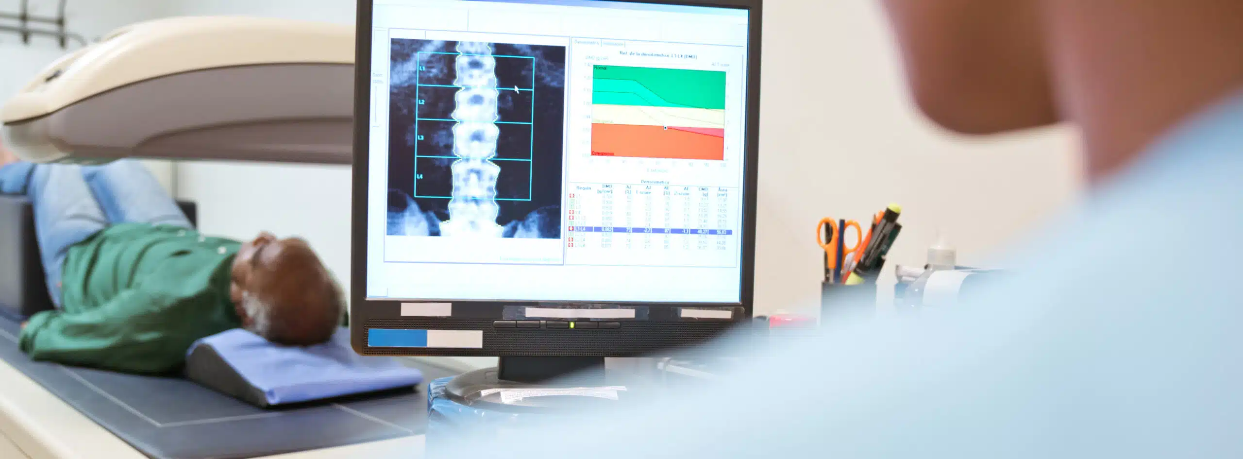 osteodensitometrie