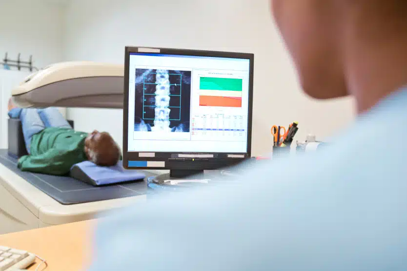 osteodensitometrie