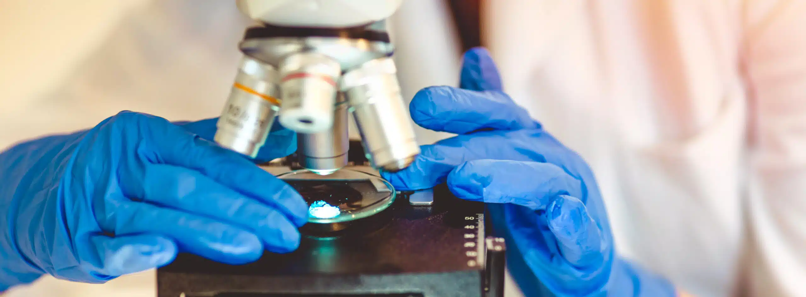 cytoponction ou biopsie