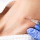 Dans quelles zones peut-on faire une cytoponction ?