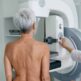 À quelle fréquence faire une mammographie ?