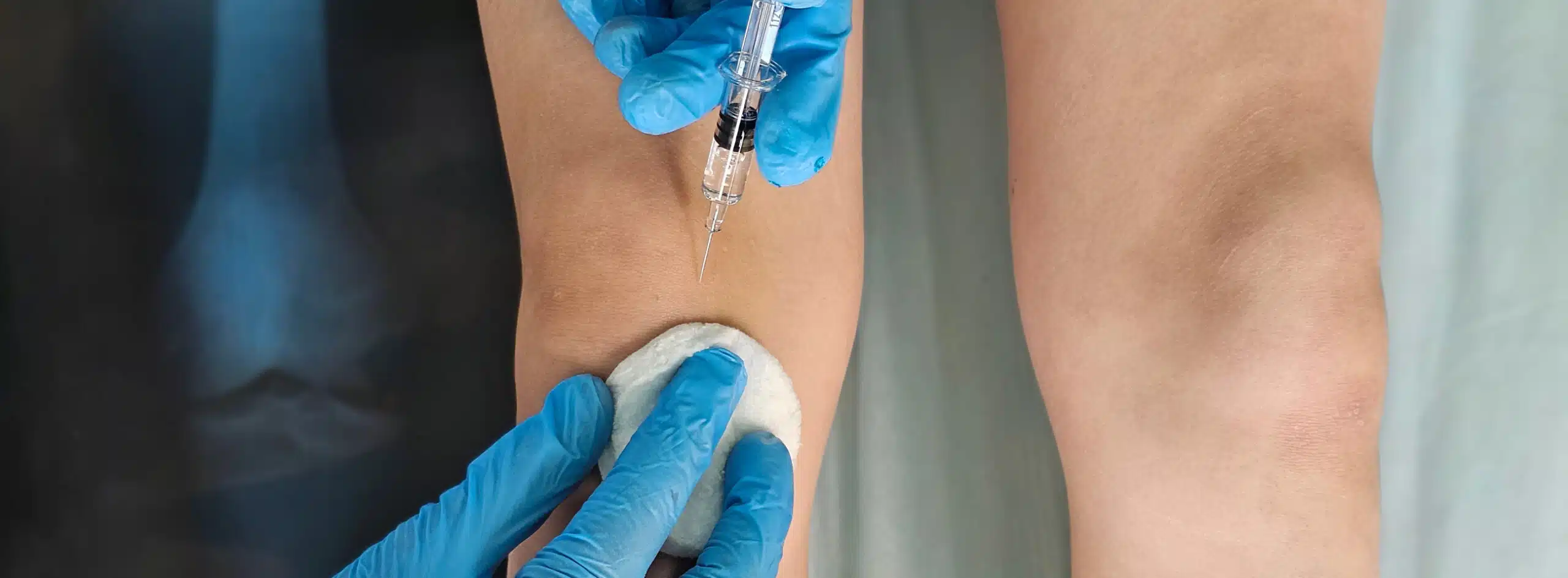 Infiltrations périphérique