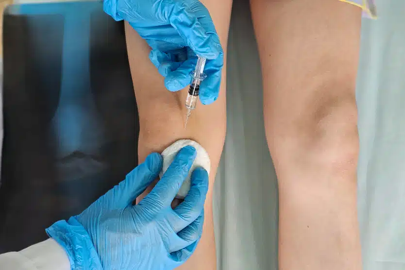 Infiltrations périphérique