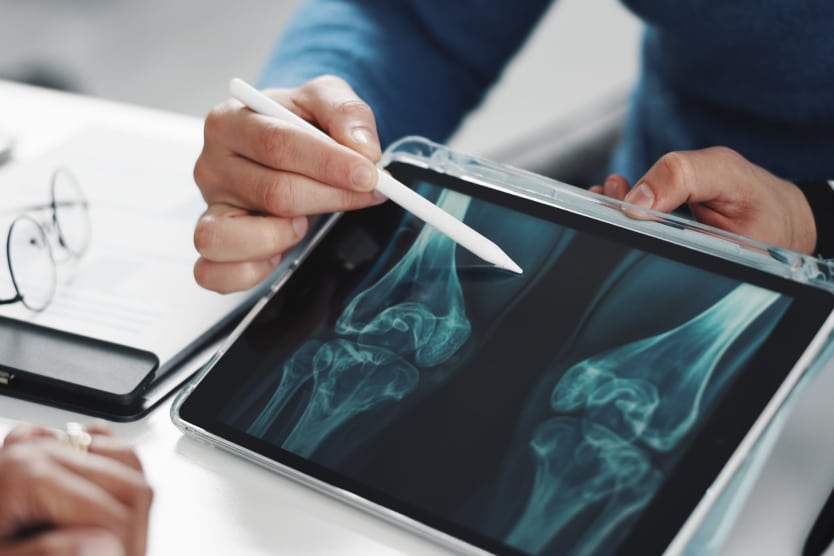 IRM genou nécessaire douleur blessure | Radiologie | Révélis | Paris